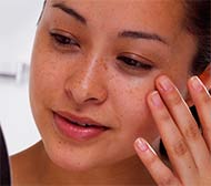 taches pigmentaires sur le visage